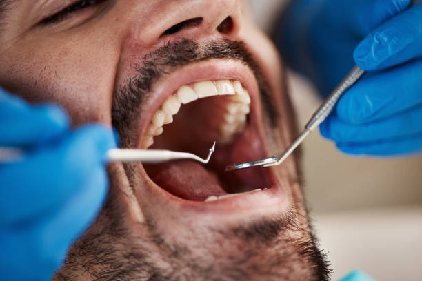 Best Dentist for Tooth Abscess  in Johnsonburg, PA